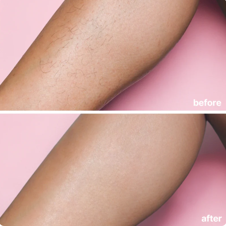 Bare Basics No Shave Hair Removal Cream