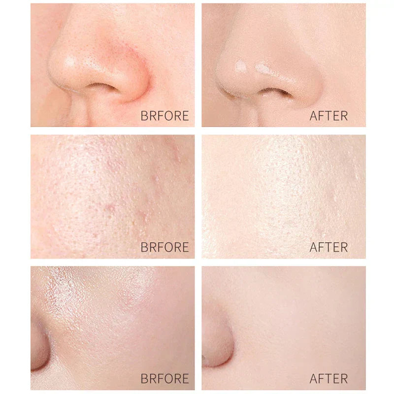 24K Gold Snail Collagen Peel