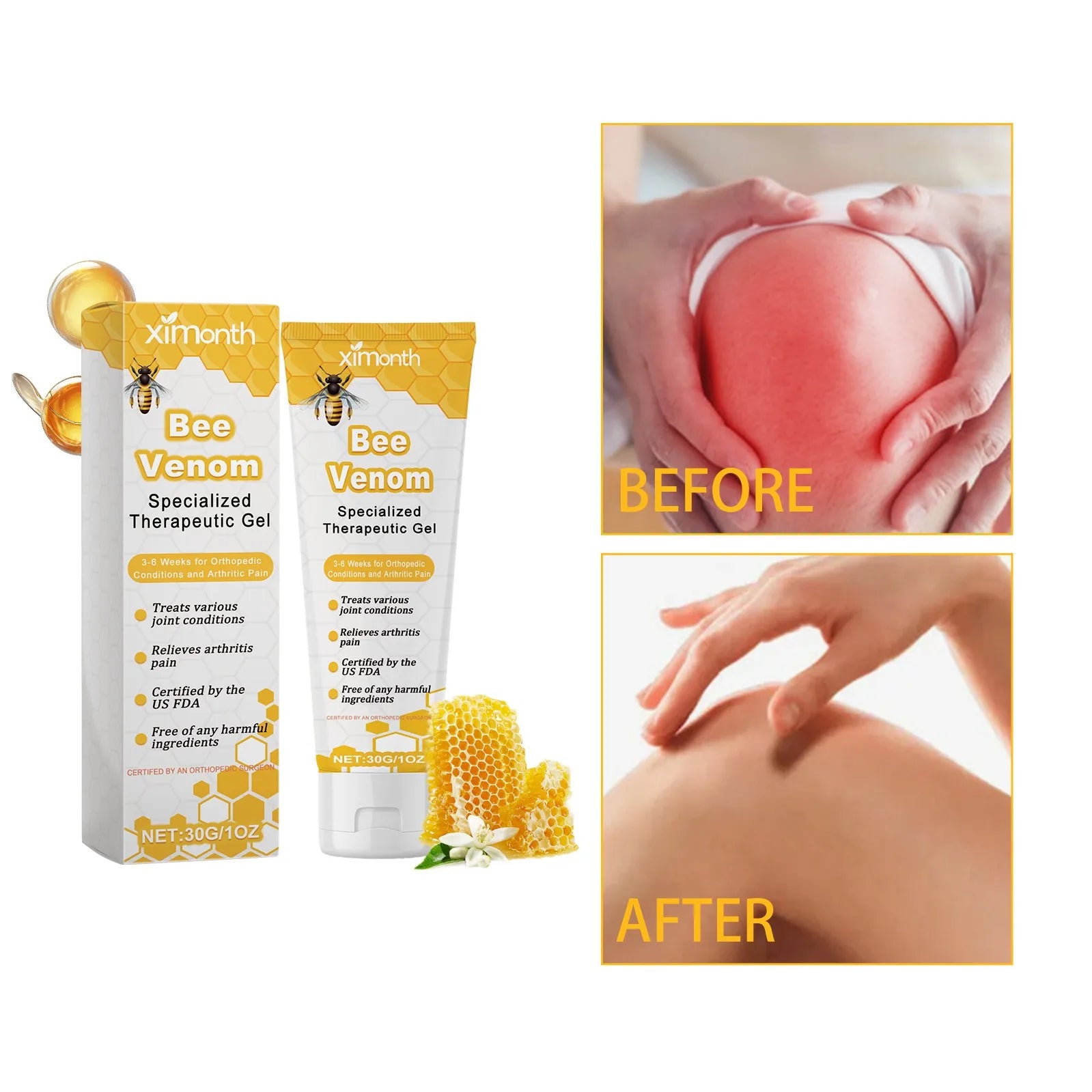 Bee Poison Joint Therapy Pain Relief Gel