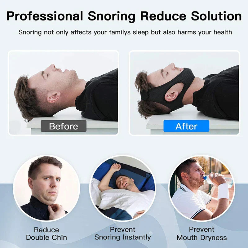 Anti-Snoring Chin Strap