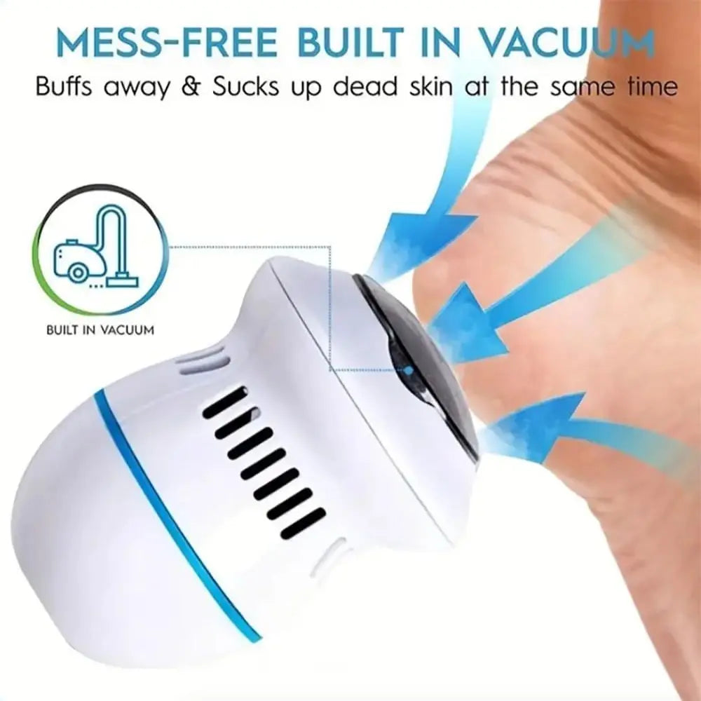 Automatic Callus Remover
