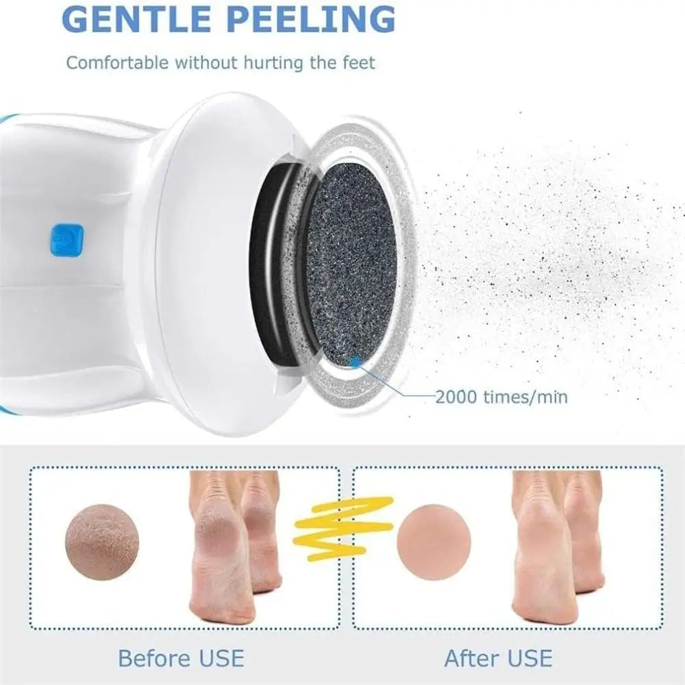 Automatic Callus Remover