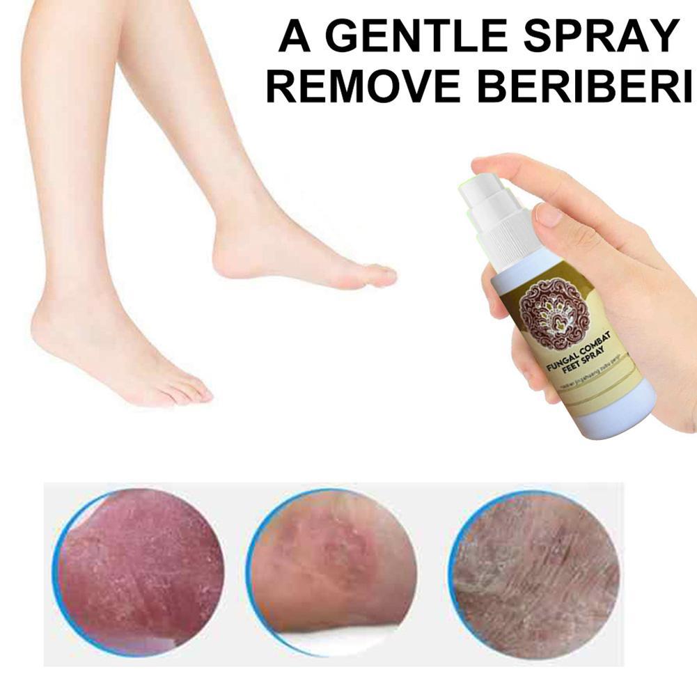 Anti-Fungal Treatment Spray